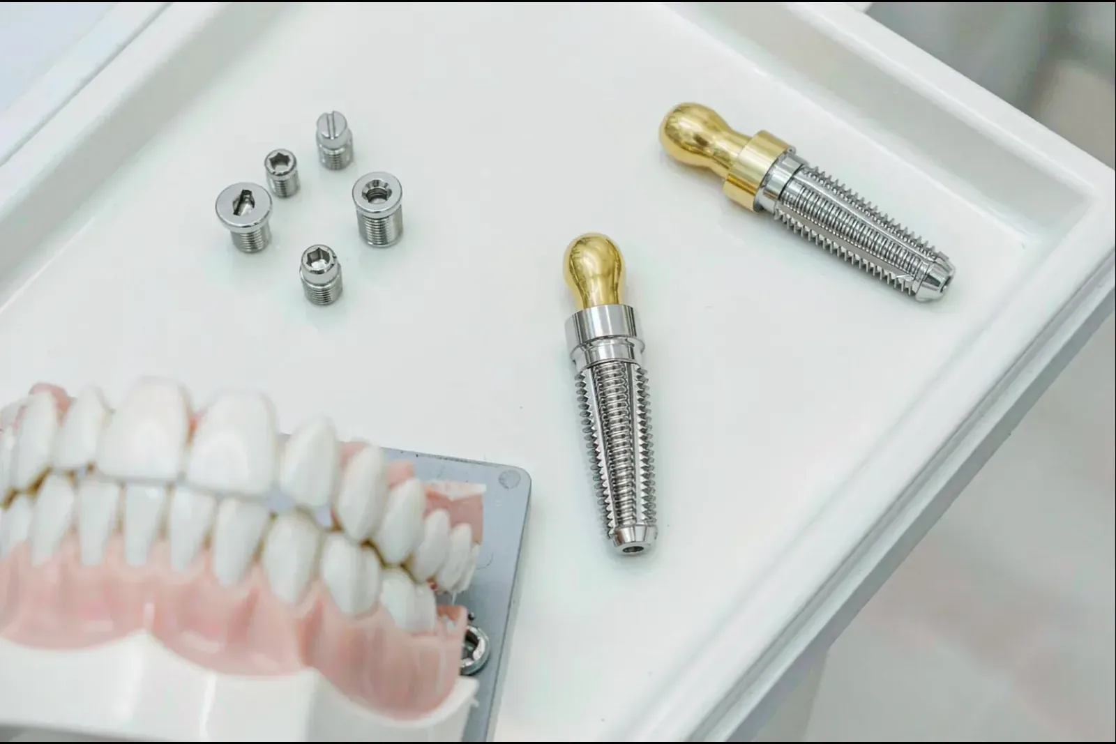 Dental Implants in China: A Cost & Process Guide